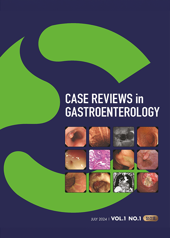 저널 그룹 제목 'Case Reviews in Gastroenterology'의 대표 이미지