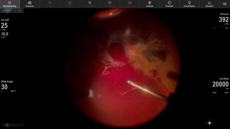 VOD 제목 'DM TRD tissue detail mode'의 대표 이미지