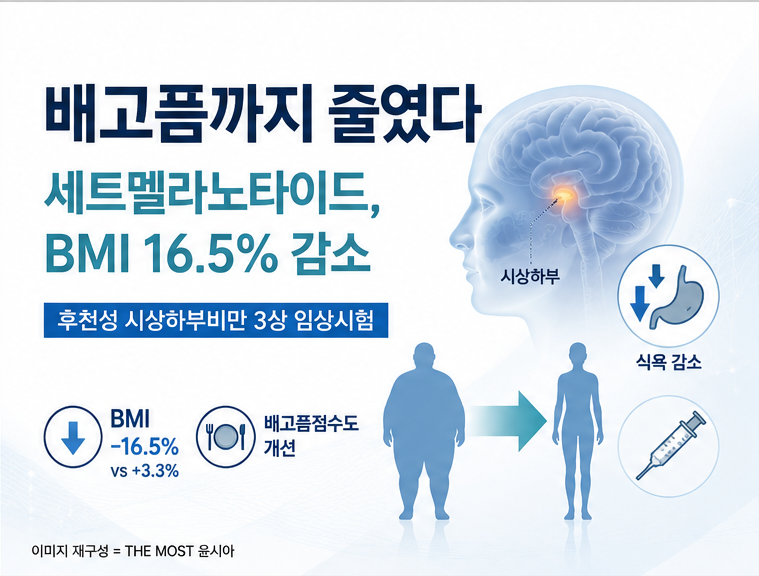 기사 제목 '시상하부비만서 BMI 16.5% 감소…중대한이상반응 28%'의 대표 이미지