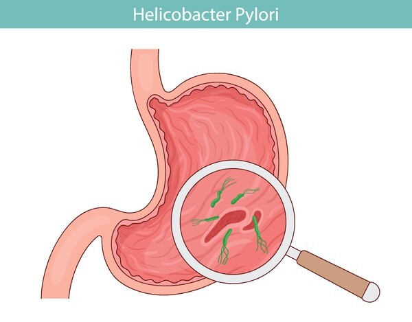 Green bacterium Helicobacter pylori. stomach disease. Vector illustration in cartoon style.