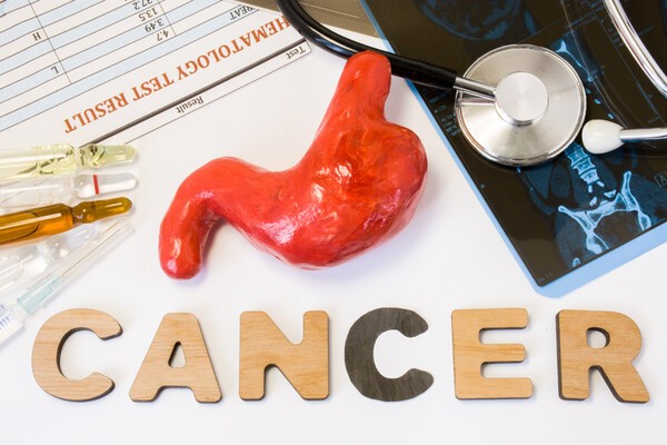 Stomach cancer concept. Anatomical shape of stomach lies near letters composing word cancer surrounded by set of tests, analysis, drugs, MRI and stethoscope. Diagnosis treatment of gastric cancerous