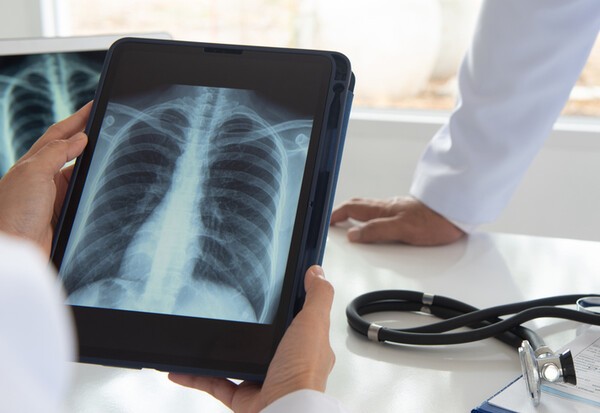 doctor diagnose lung x-ray image on digital tablet screen with radiologic technologist team.