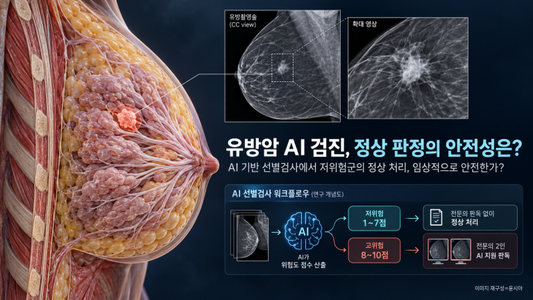 기사 제목 '유방암 검진 AI 단독 ‘정상’ 판정…놓친 암은 없었을까?'의 대표 이미지